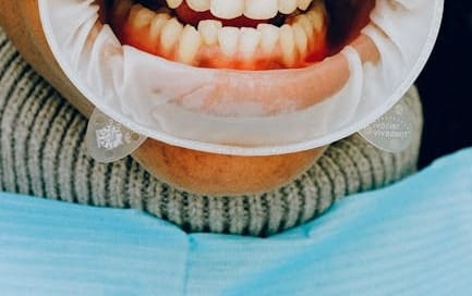 Are nicotine pouches bad for your gums?