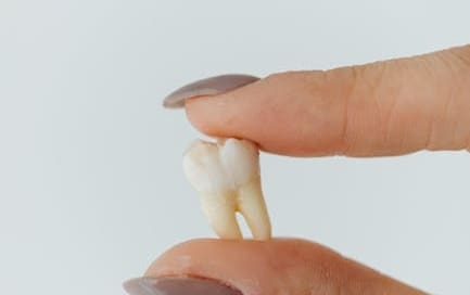 nicotine pouches after tooth extraction